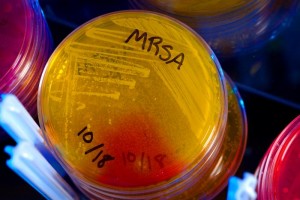A drug-resistant strain of bacteria known as MRSA. Photo by James Gathany