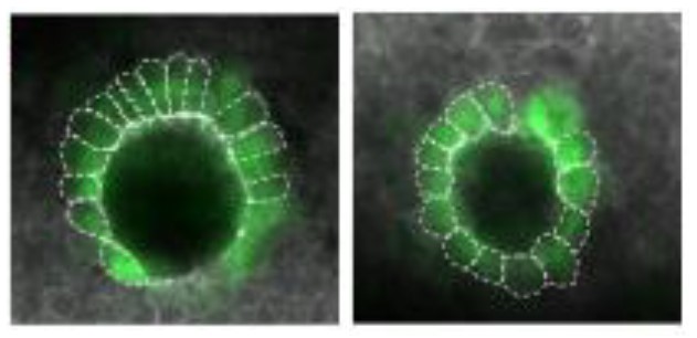 Micrograph of a zebrafish organ called the Kupffer's vesicle