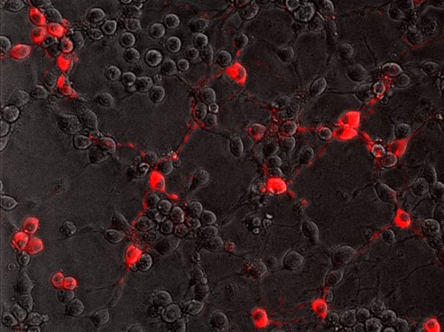 Cells in red against black background